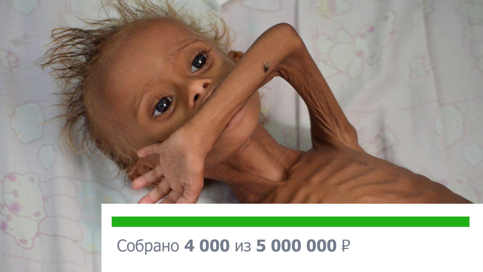 2,2 млн детей в Йемене голодают