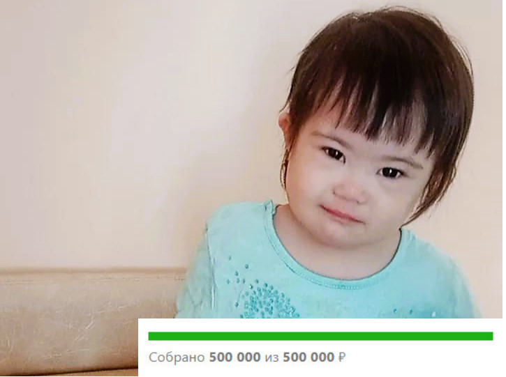 У Мадины ВПС, нужна операция